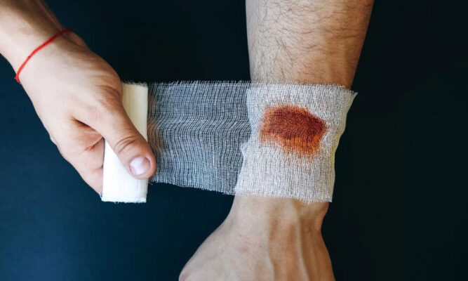 ترفندهای طلایی جلوگیری از چسبیدن گاز استریل به زخم