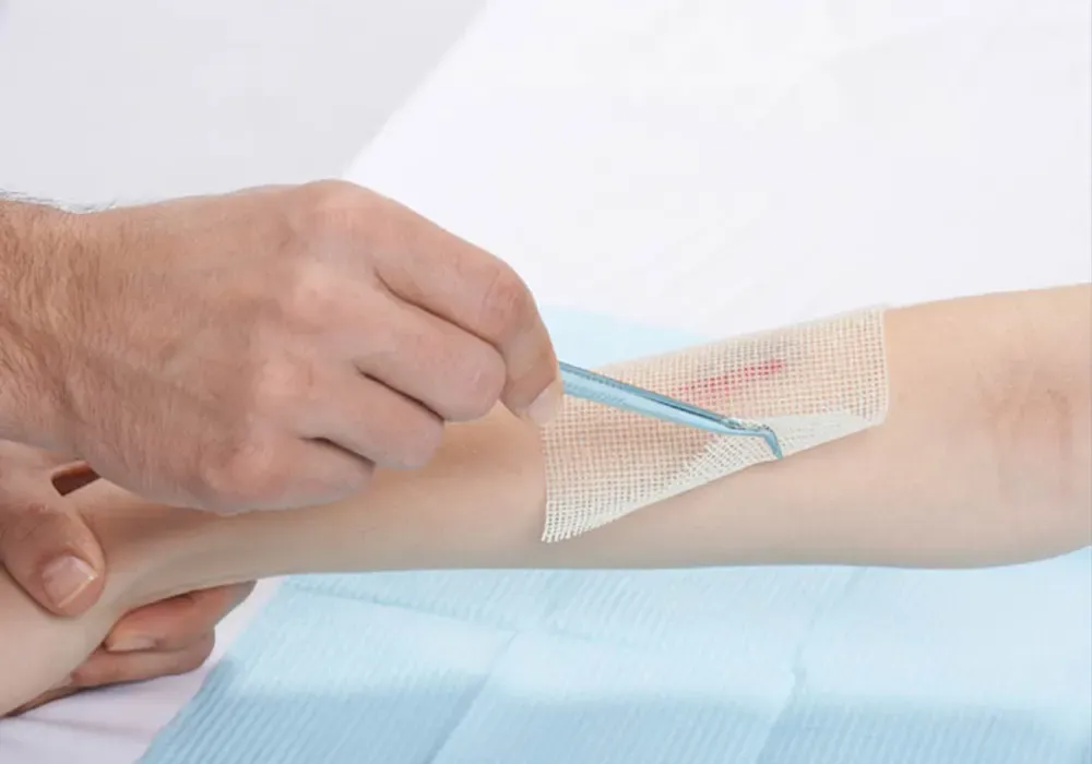 مزایای استفاده از گاز استریل